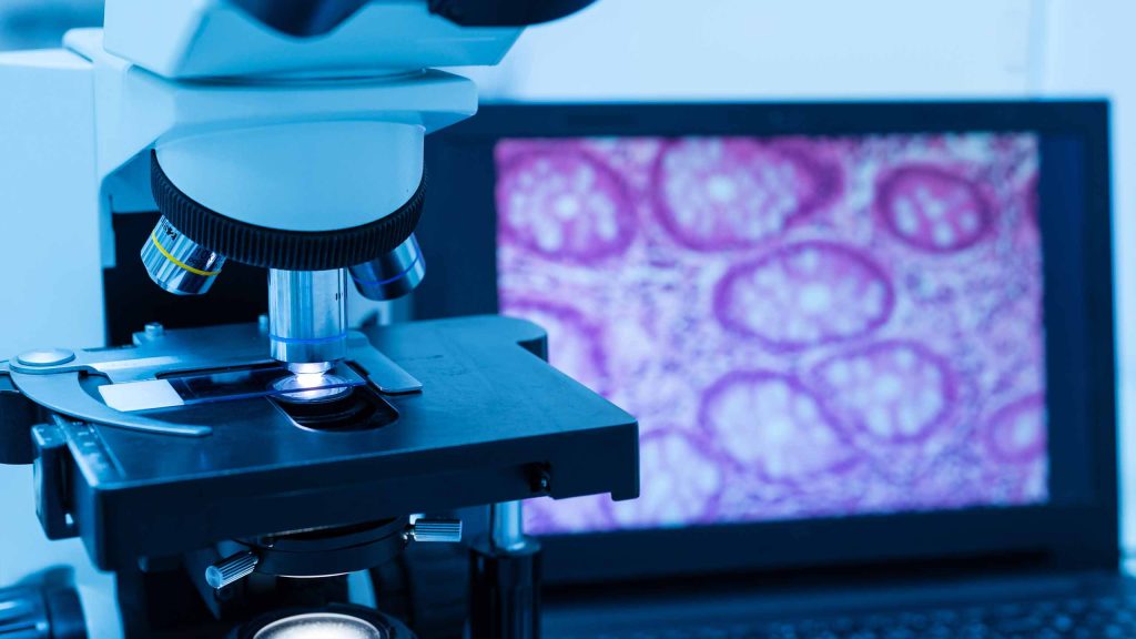 Hawaii Cancer Diagnosis Pathology